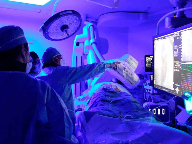 El dispositivo de protecci&oacute;n emb&oacute;lica fue utilizado por primera vez en Nuevo Le&oacute;n en el Hospital Zambrano Hellion.
