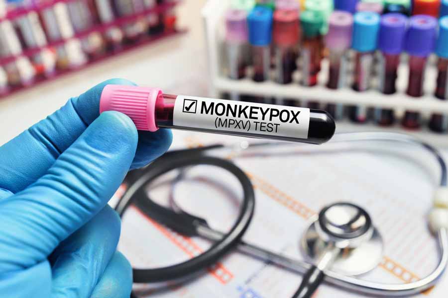 C&oacute;mo se contagia la viruela del mono