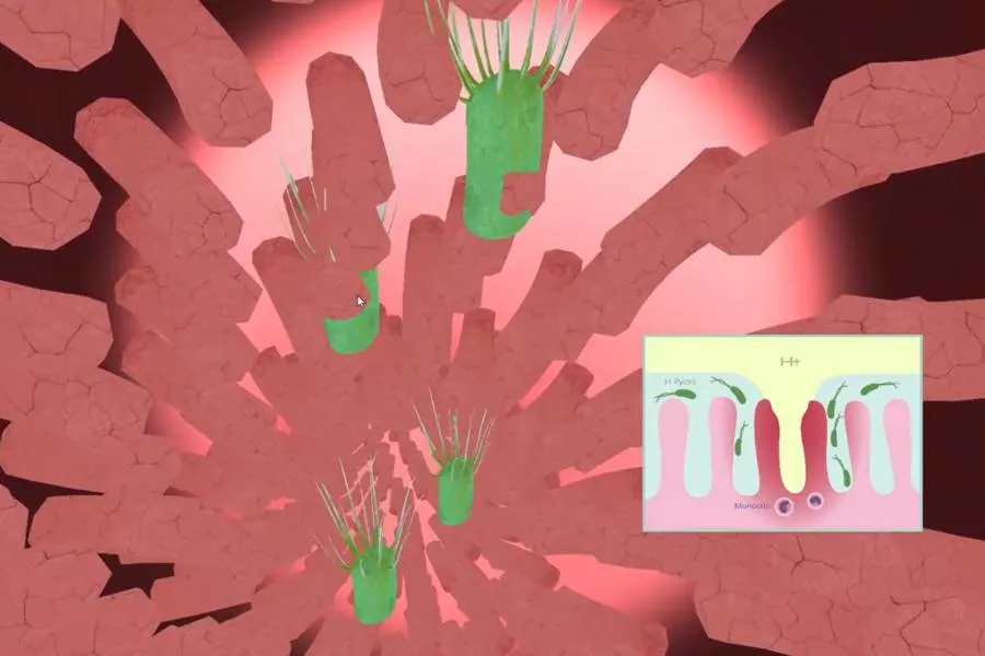 Vistazo del video inmersivo de una infecci&oacute;n bacteriana